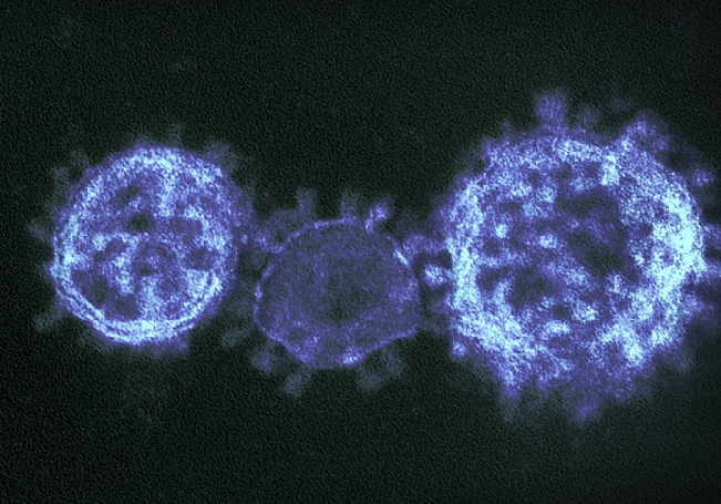 22022020 Coronavirus Aguascalientes