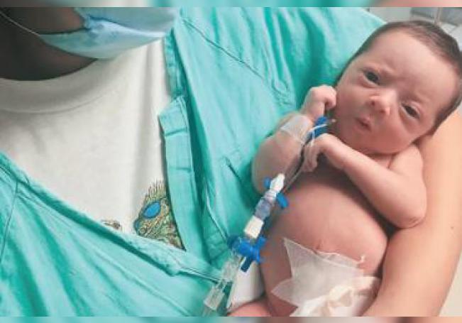 Salvan la vida a una bebé con exitosa intervención