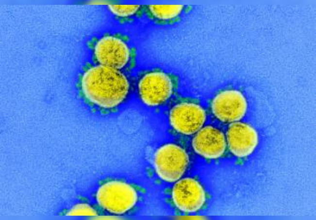 Coronavirus: Siguen en aumento los contagios en Aguascalientes