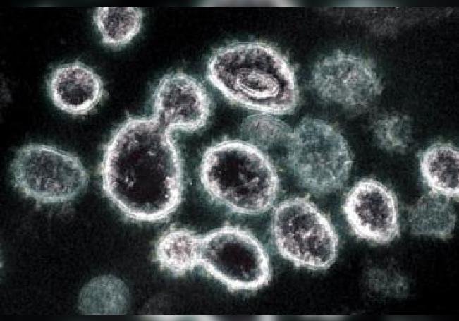 Coronavirus: Confirman aumento a 423 contagios en Aguascalientes