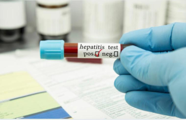 Alerta por la aparición de la hepatitis A