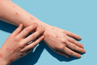 0fc46a2f7c0516d68673454b54d2e03f