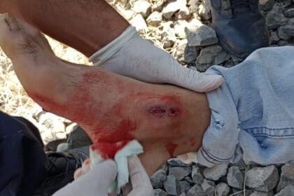 BALEADO 2 e1677102844300