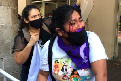 activista herida guerrero 24022021 scaled 1