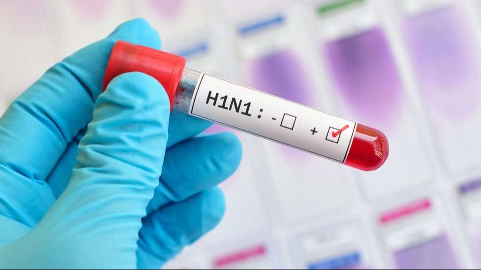 influenza 5