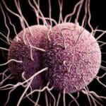 super gonorrea 22122020