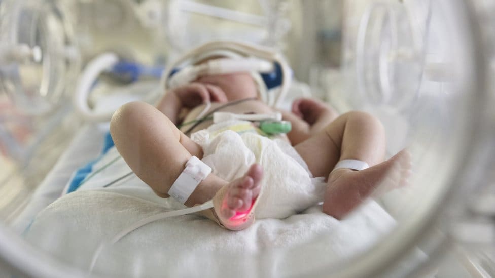 Virus sincicial provocó muerte de dos bebés