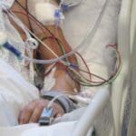 Muere segundo paciente con Covid-19 en Morelos