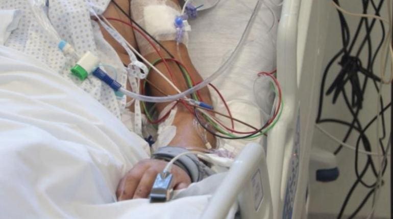 Muere segundo paciente con Covid-19 en Morelos