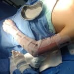 Atienden exitosamente a niño con quemaduras