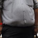 Obesidad alcanza proporciones de pandemia