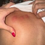 Chinches en los Hoteles 4