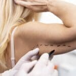 close up hand drawing patient