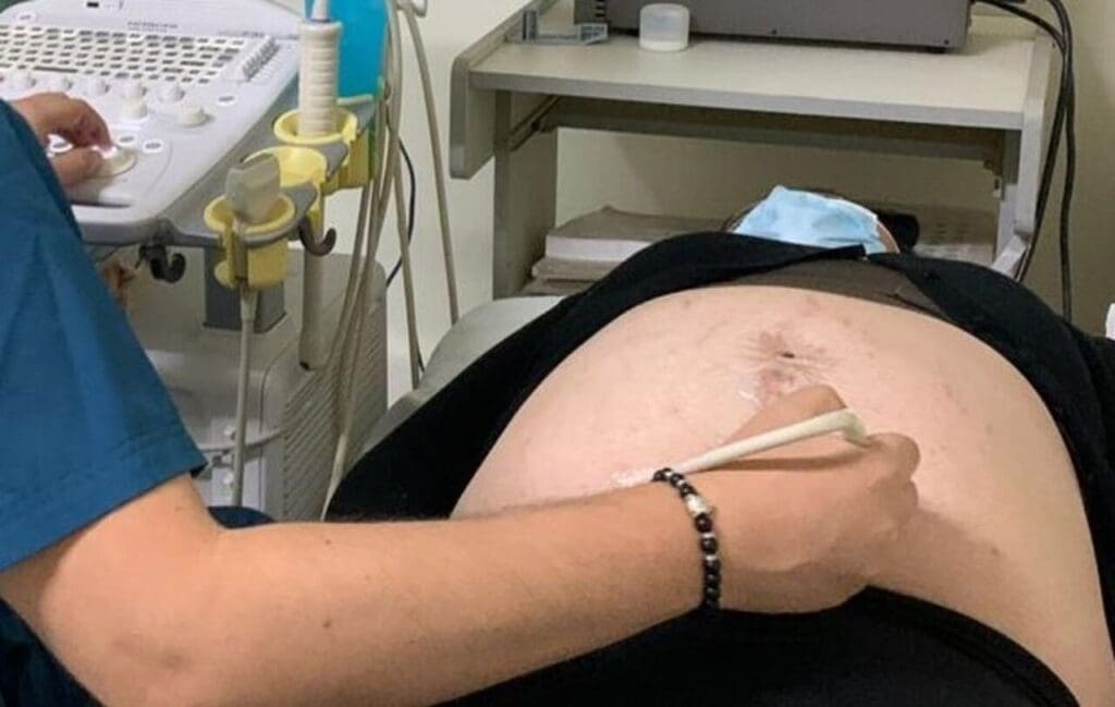 JLB DESMIENTEN Abortos 1 1