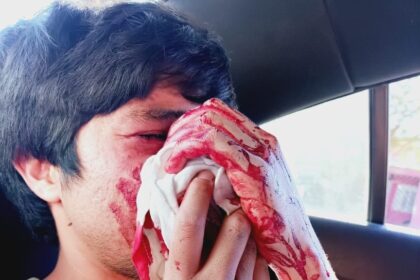 Sin titulo 3 e1730961507297