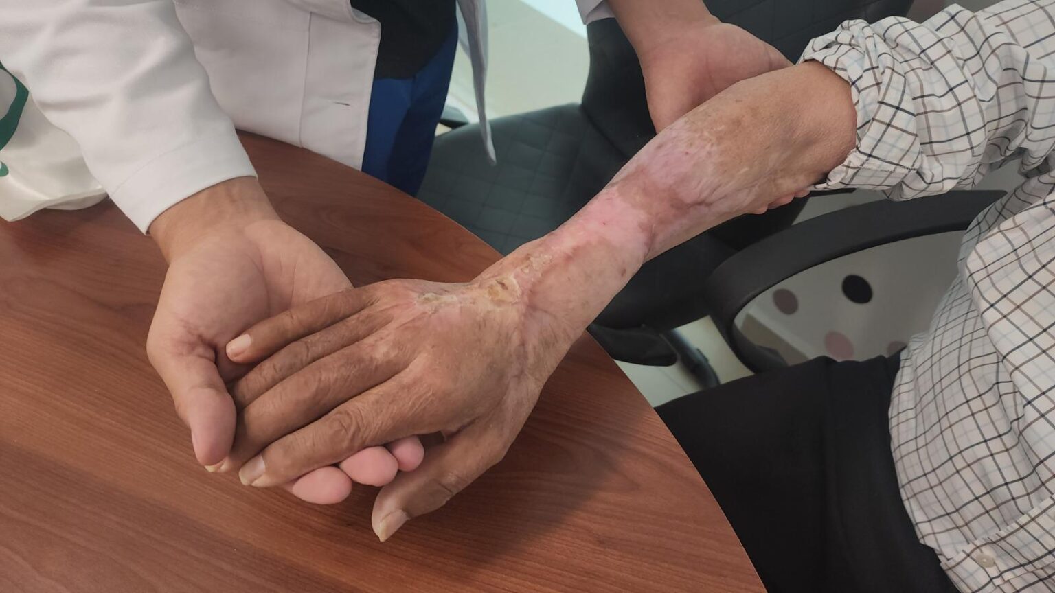 El brazo del adulto mayor, visiblemente recuperado