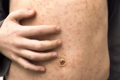 Al momento 9 especímenes han sido estudios en el laboratorio