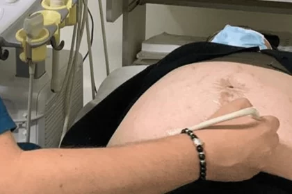 Antiabortistas buscan rescatar cuerpo y órganos para darles sepultura.