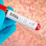 Hasta la semana 28 del 2025 suman 272 casos contra 172 del año anterior.