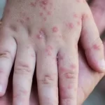 – Aguascalientes solo ha notificado casos sospechosos, ninguno positivo