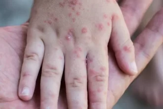 Con el regreso a clases hay que estar atentos de los más pequeños