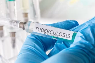 “El riesgo de que haya brotes de las formas graves de tuberculosis entre los infantes se debe a que hay un retraso importante en la entrega de vacunas que ha impedido la protección de los menores