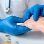 Médico es el tercer caso de sarampión