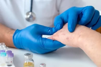 Médico es el tercer caso de sarampión