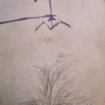 Retiran tumor gigantesco a joven en HGZ 3 del IMSS