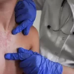 Sarampión ataca a chicos y grandes