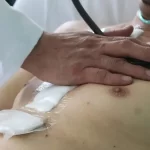 Segunda víctima mortal de influenza en Aguascalientes