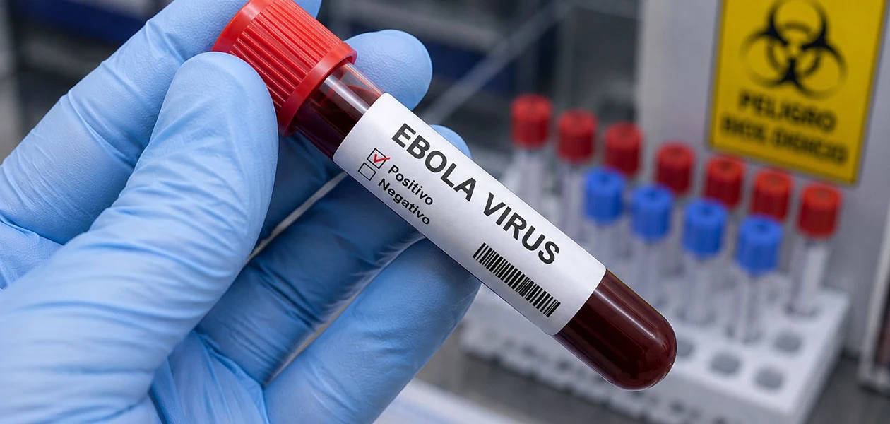 Por alerta de ébola emiten Aviso Preventivo de Viaje