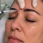 Ahora detectan bótox falsificado