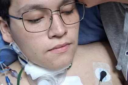 Percance en moto cambia la vida de jovencito