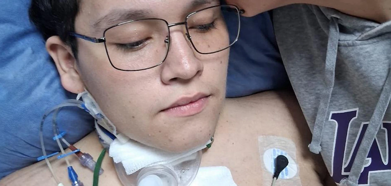 Percance en moto cambia la vida de jovencito