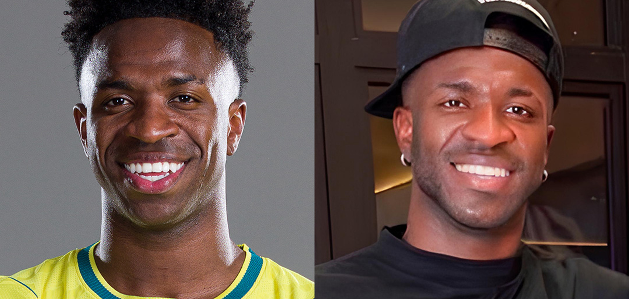 Vinícius Jr. se somete a una cirugía estética facial tras el Mundial